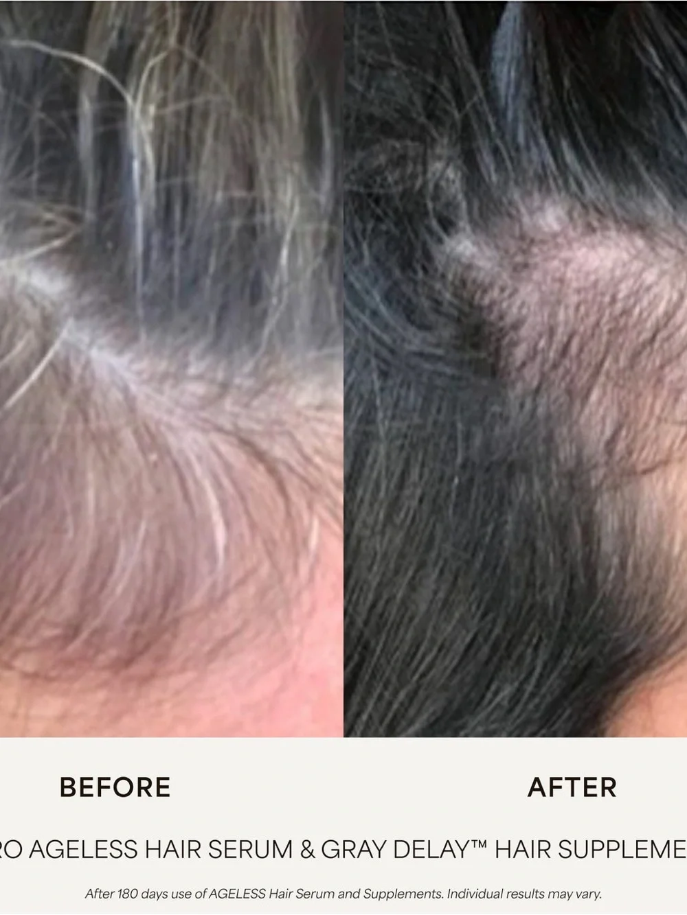 VEGEMOUR GRO AGELESS Anti-Gray Hair Serum • FULL SIZE SEALED 1 Oz. Bottle NEW!